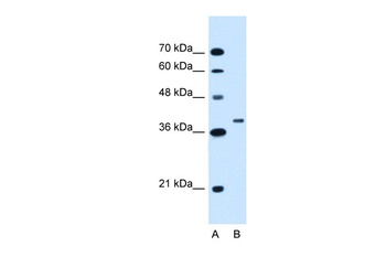 RNF146 Antibody