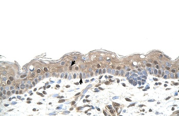 RNF25 Antibody