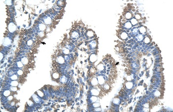 RNF121 Antibody