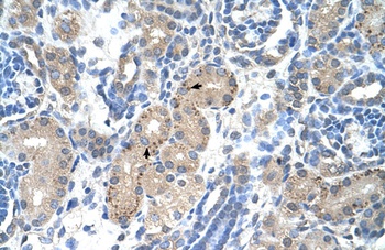 FOXR2 Antibody