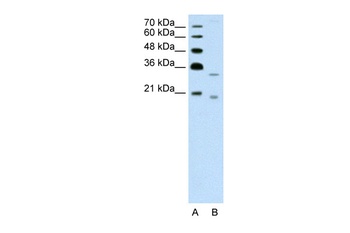 DNASE2B Antibody