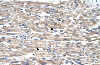 BMP2K Antibody