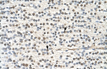 GAPVD1 Antibody