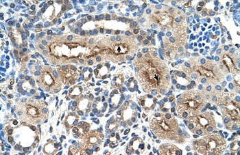 CLEC4M Antibody