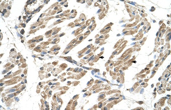 SLC6A8 Antibody