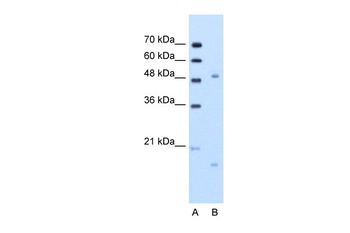 ITGBL1 Antibody