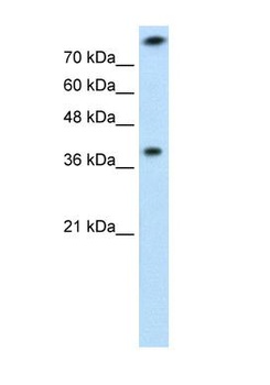 TST Antibody