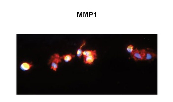 MMP1 Antibody
