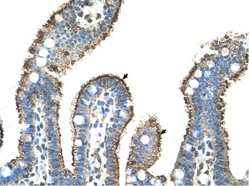 MMP1 Antibody