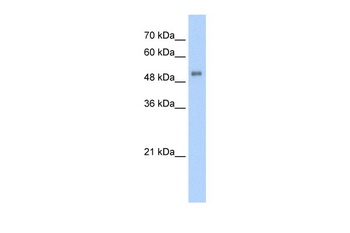 ALAS2 Antibody