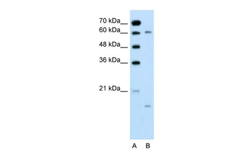 CYP4A22 Antibody