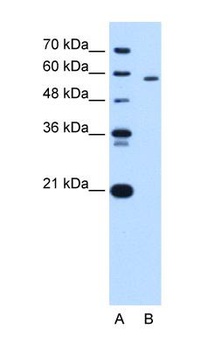 PKLR Antibody