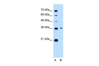 C11orf54 Antibody