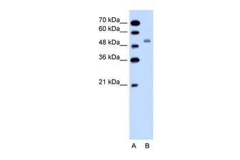SLC12A1 Antibody