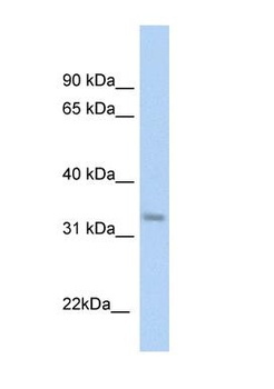 KHK Antibody