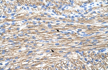 MBNL1 Antibody