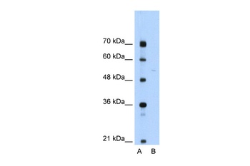 SEPSECS Antibody