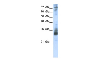TRMT10A Antibody