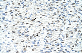 MATR3 Antibody