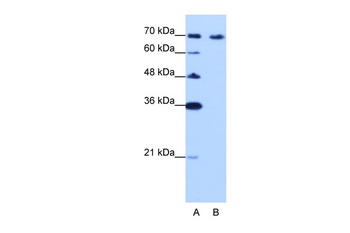 CDKN2AIP Antibody