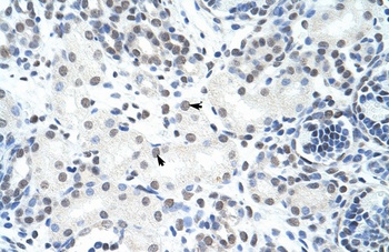 HNRNPH3 Antibody