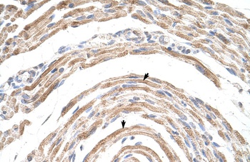 CPSF6 Antibody