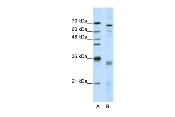 SRSF1 Antibody