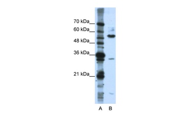 KHDRBS3 Antibody