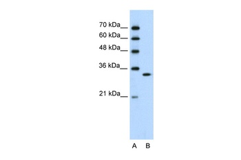 RNASEH2A Antibody