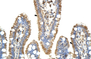 KARS Antibody