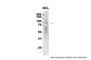 NCL Antibody