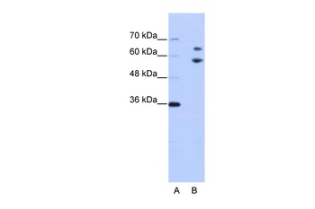 TROVE2 Antibody