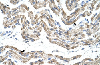 TRA2B Antibody