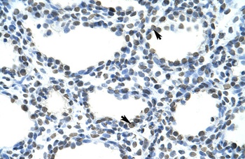 TRA2B Antibody