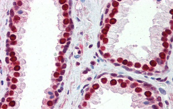SSB Antibody