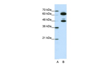 SNRNP70 Antibody