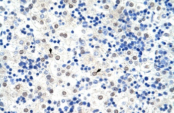 HNRPL Antibody