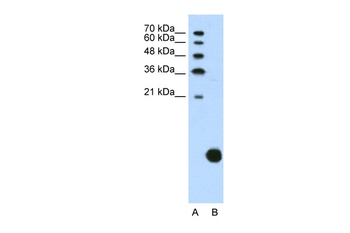 RPS29 Antibody