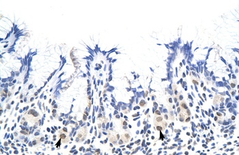 HNRNPA1L2 Antibody