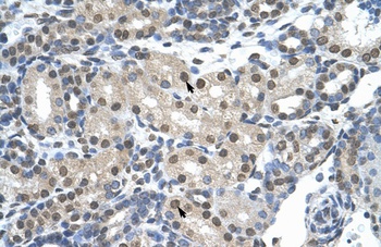 SNRNP70 Antibody