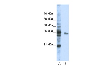 EXOSC3 Antibody