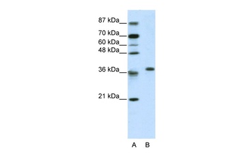 RPL6 Antibody