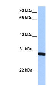 SMN1 Antibody