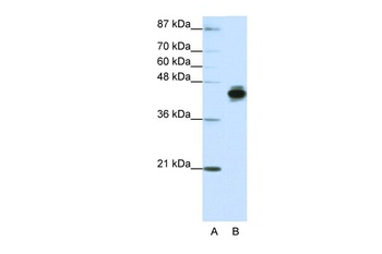 KRT18 Antibody