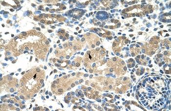DMRT2 Antibody