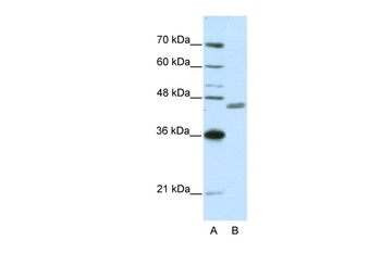 ZNF396 Antibody