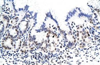 ZNF296 Antibody