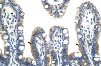 BTBD6 Antibody