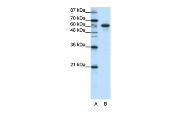 CBLL1 Antibody