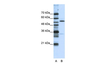 ZNF655 Antibody